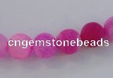 CAG7505 15.5 inches 10mm round frosted agate beads wholesale