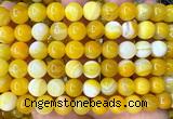 CAA6363 15 inches 10mm round yellow banded agate beads wholesale