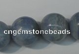 CAG4377 15.5 inches 20mm round dyed blue lace agate beads