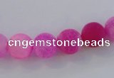 CAG7503 15.5 inches 6mm round frosted agate beads wholesale