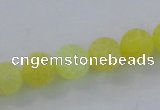 CAG7519 15.5 inches 6mm round frosted agate beads wholesale