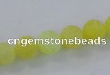 CAG7523 15.5 inches 14mm round frosted agate beads wholesale
