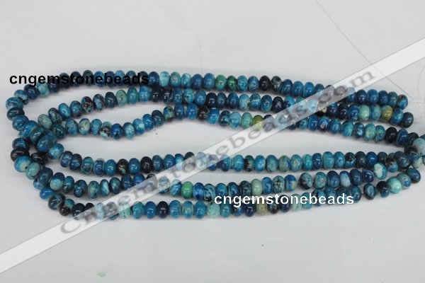 CCO170 15.5 inches 5*8mm rondelle dyed natural chrysotine beads