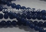 CCT1122 15 inches 2mm round tiny cats eye beads wholesale