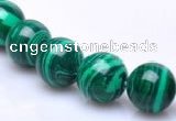 CMA20 15.5 inches 10mm round imitate malachite beads Wholesale