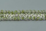 CPB722 15.5 inches 8mm round Painted porcelain beads